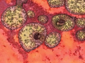 Elevated hormone flags liver problems in mice with methylmalonic acidemia