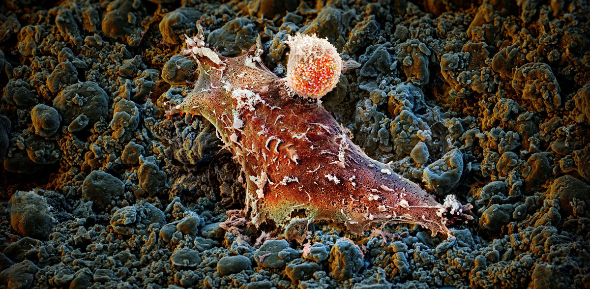 Stronger together: a new fusion protein boosts cancer immunotherapy