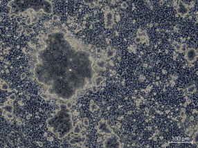 Gene modification enables more functional liver cells from stem cells