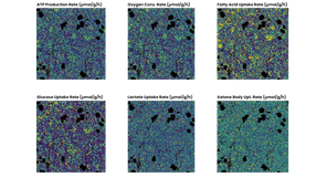 Single-cell metabolism from FFPE tissue: precise insight ...
